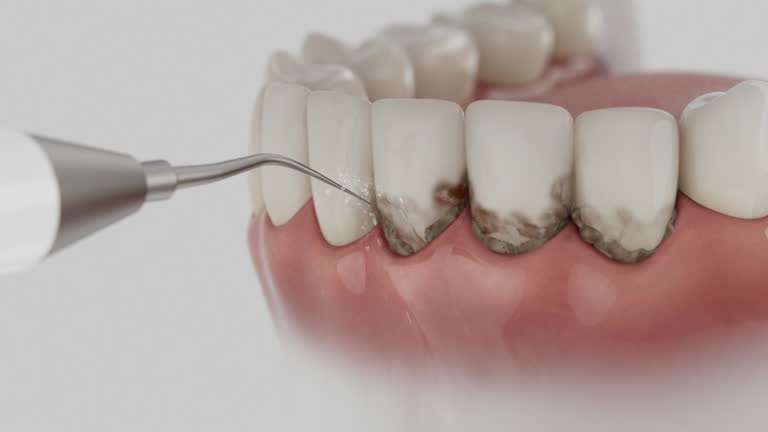 Reliable Dental contractor in Fairview, CA by Smile Center Dentistry